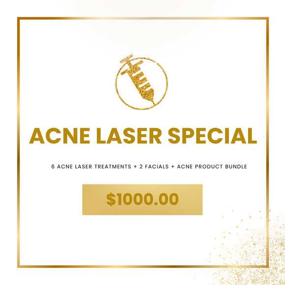 Acne Laser Special